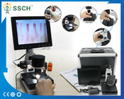 CE Approved LCD Screen Medical Microscope Capillary Microcirculation