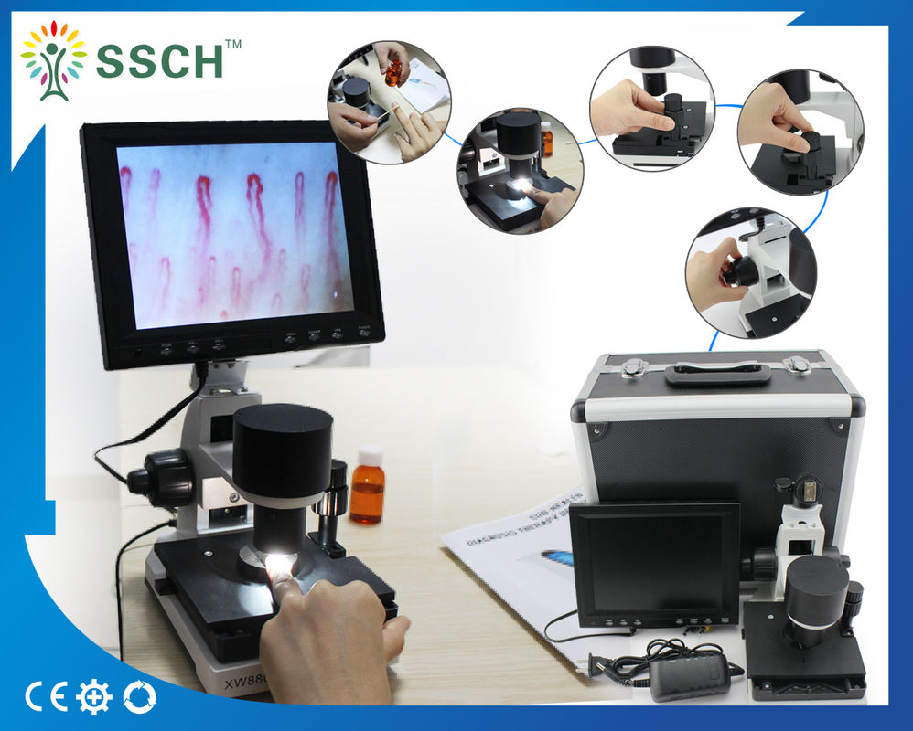 CE Approved LCD Screen Medical Microscope Capillary Microcirculation