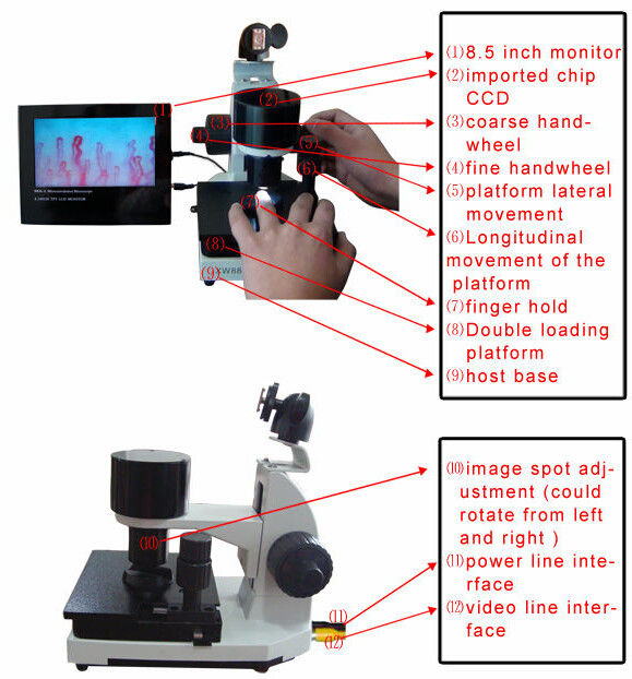 High Accuracy Nail Folding Microcirculation Microscope with High Definition Video Screen 8 inch