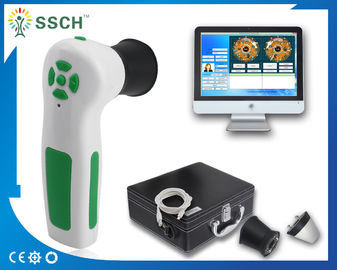 White Iriscope Iridology Camera USB Skin Scanner Diagnosis Analyzer