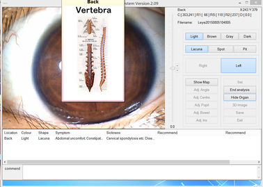 Medical 12.0MP USB Iris Scope Megapixel Digital Camera Eye Iris Analyzer