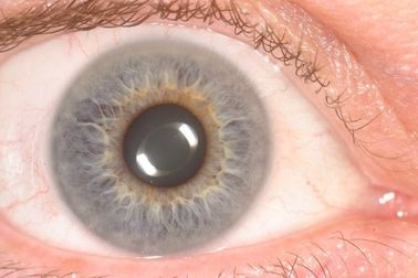 Portable CE Handheld Eye Iris Scanner Analyzer For Health Detect