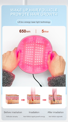 650nm Lllt Red Light 200 Diode Hair Loss Treatment Laser Helmet Hair Growth