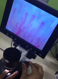 Next Generation Microcirculation Microscope , Blood Vessel Microscope For Healthcare