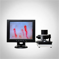 LCD Display Health Analyzer Machine Clinical Blood Analysis Microcirculation Microscope