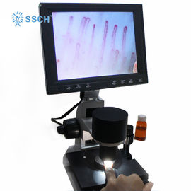 Capillary Microcirculation Medical Microscope Magnification Over 380 Times