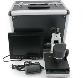 600cd/m2 Microcirculation Microscope Nailfold Capillary Test Connected To Laptop