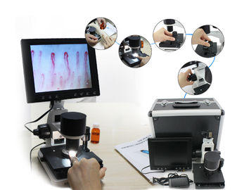 600cd/m2 Microcirculation Microscope Nailfold Capillary Test Connected To Laptop