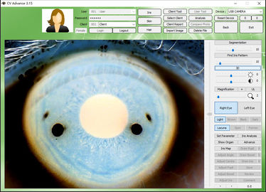 12.0MP Digital Iriscope Iridology Camera Eye Testing Machine CE/DHL Approval