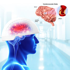 810nm Light Therapy Machine Neurofeedback Therapy Machine Transcranial Magnetic Brain Stimulation