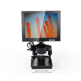 Portable 10 Inch LED Display Nail Fold Capillaroscopy Microcirculation Test Machine