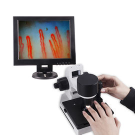 Blood Capillary Microcirculation Microscope 600X Magnification DC12V 2A Output