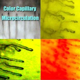 Hospital Nailfold Capillary Microscopy /  Microcirculation Microscope Multi Function for Medical