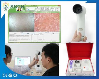 Facial Skin Moisture Analyzer Machine Skin Scope Analyzer Multi Function and Security